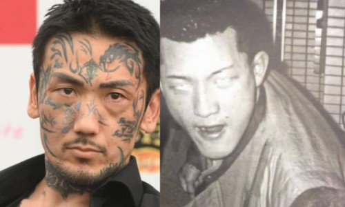 颞叶症状群网 :分享颞叶痫病是什么病-颞叶是啥知识
